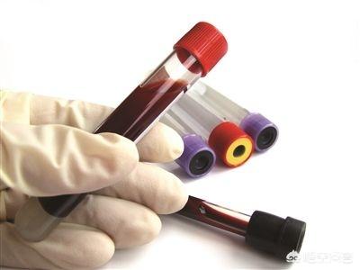 多久检查一次血脂比较合适？