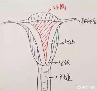 Y型不完全纵格子宫，怀孕后能否生下健康的孩子，可以顺产吗？